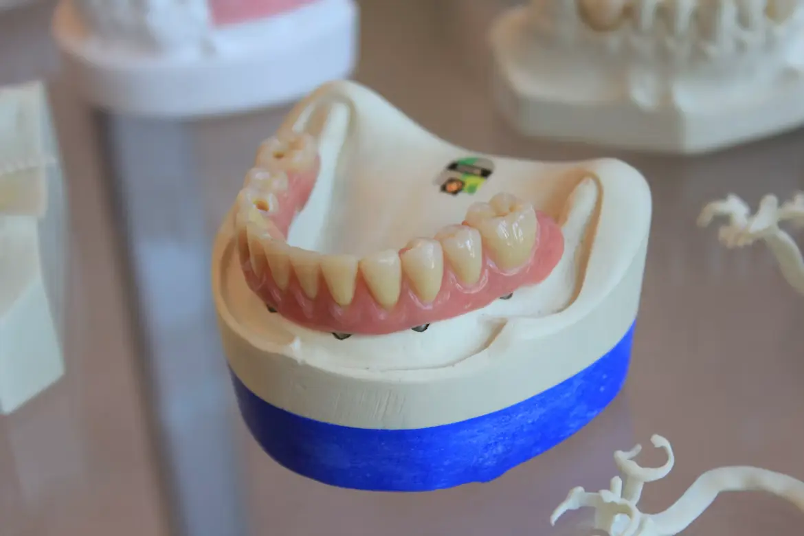 Prótesis dentales y coronas en Caballito